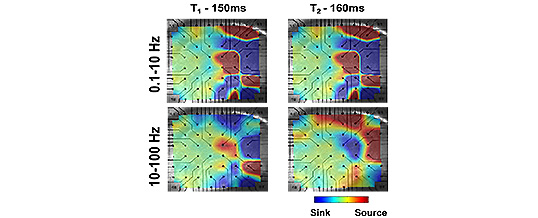 Dynamics of high-frequency synchronization during seizures. Krishnan GP, Filatov G, Bazhenov M. J Neurophysiol. 2013 May;109(10):2423-37.